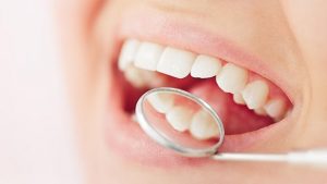 Oral_HealthyTeeth_001213_616x347px_A0917